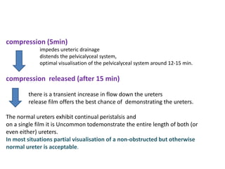 compression (5min)
impedes ureteric drainage
distends the pelvicalyceal system,
optimal visualisation of the pelvicalyceal system around 12-15 min.
compression released (after 15 min)
there is a transient increase in flow down the ureters
release film offers the best chance of demonstrating the ureters.
The normal ureters exhibit continual peristalsis and
on a single film it is Uncommon todemonstrate the entire length of both (or
even either) ureters.
In most situations partial visualisation of a non-obstructed but otherwise
normal ureter is acceptable.
 