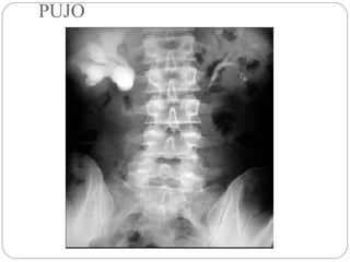 PUJO
 