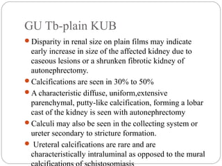 GU Tb-plain KUB
Disparity in renal size on plain films may indicate
early increase in size of the affected kidney due to
caseous lesions or a shrunken fibrotic kidney of
autonephrectomy.
Calcifications are seen in 30% to 50%
A characteristic diffuse, uniform,extensive
parenchymal, putty-like calcification, forming a lobar
cast of the kidney is seen with autonephrectomy
Calculi may also be seen in the collecting system or
ureter secondary to stricture formation.
 Ureteral calcifications are rare and are
characteristically intraluminal as opposed to the mural
 