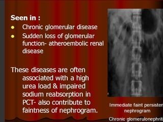 Intravenous Urography