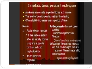 Intravenous Urography