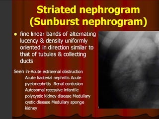 Intravenous Urography