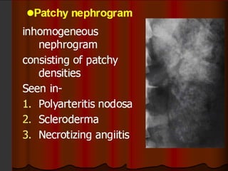 Intravenous Urography