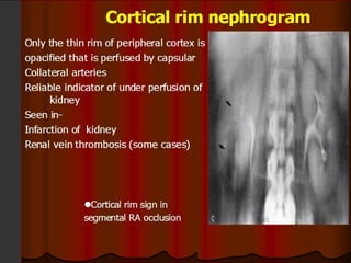 Intravenous Urography