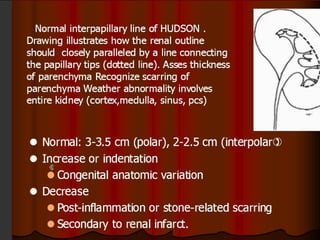 Intravenous Urography