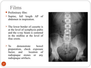 Films
Preliminary film:
 Supine, full length AP of
abdomen in inspiration.
 The lower border of cassette is
at the level of symphysis pubis
and the x-ray beam is centered
in the midline at the level of
iliac crests.
 To demonstrate bowel
preparation, check exposure
factor, and location of
radiopaque stones or any
radiopaque artifacts.
47
 