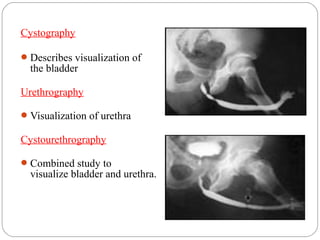 Cystography
Describes visualization of
the bladder
Urethrography
Visualization of urethra
Cystourethrography
Combined study to
visualize bladder and urethra.
 