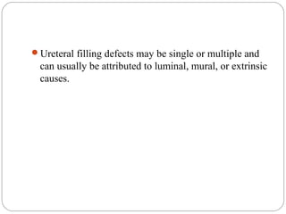 Ureteral filling defects may be single or multiple and
can usually be attributed to luminal, mural, or extrinsic
causes.
 
