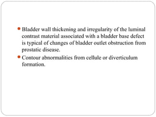 Bladder wall thickening and irregularity of the luminal
contrast material associated with a bladder base defect
is typical of changes of bladder outlet obstruction from
prostatic disease.
Contour abnormalities from cellule or diverticulum
formation.
 