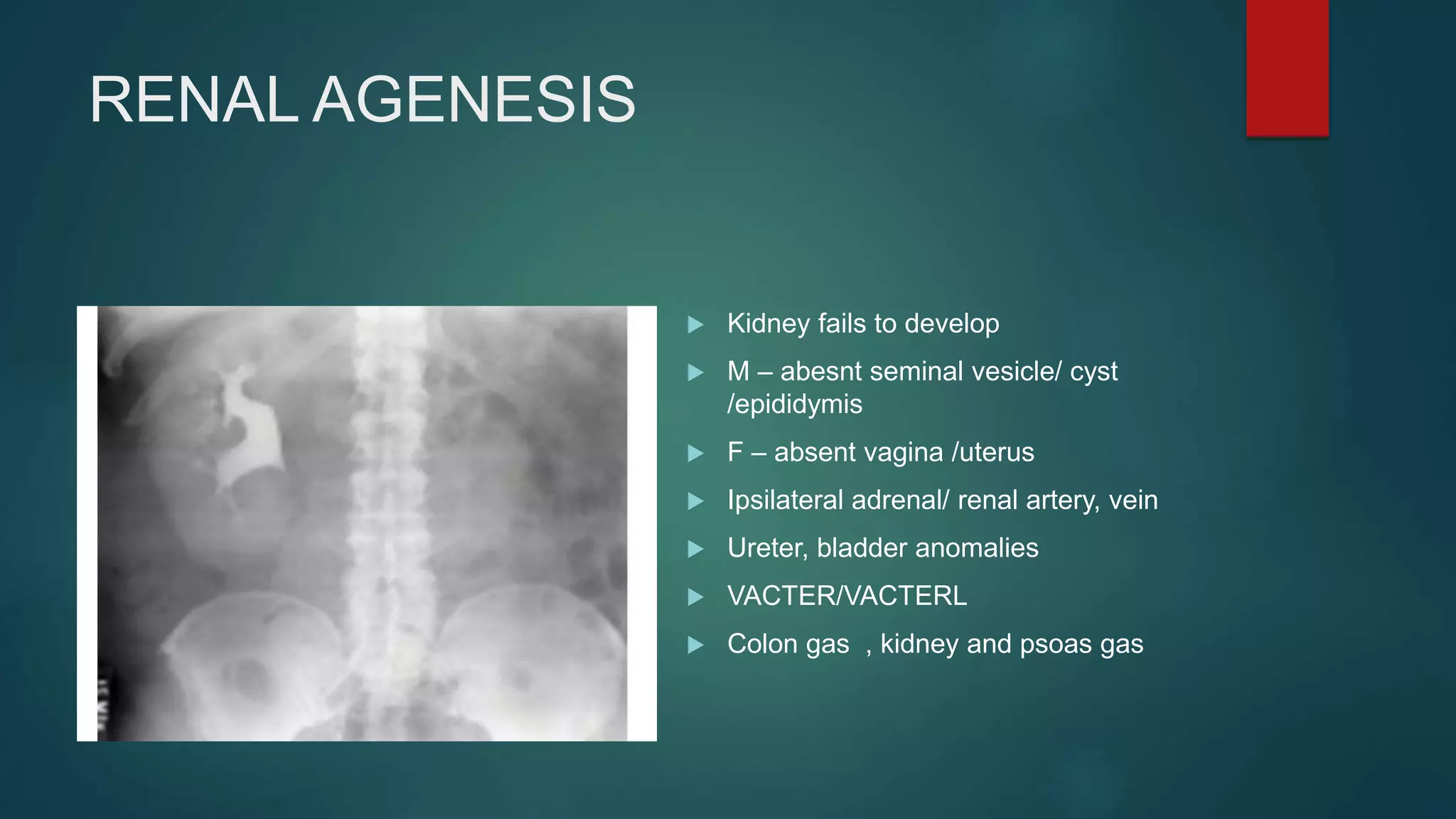 INTRAVENOUS UROGRAM ( IVU ) | PPT