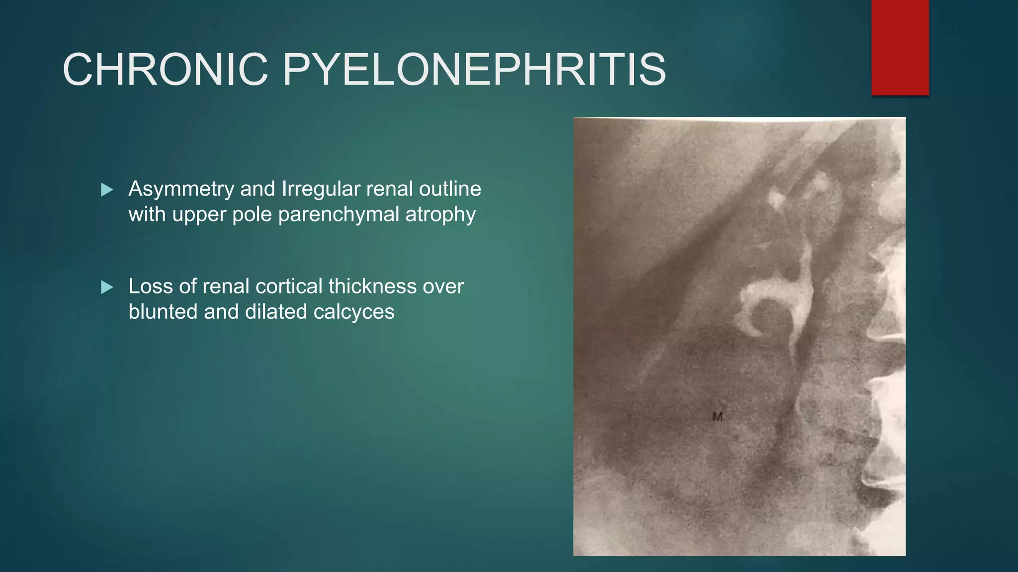 INTRAVENOUS UROGRAM ( IVU ) | PPT