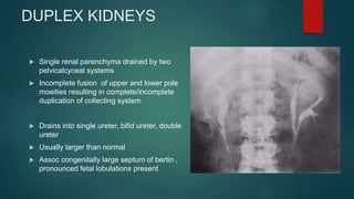 INTRAVENOUS UROGRAM ( IVU ) | PPTX