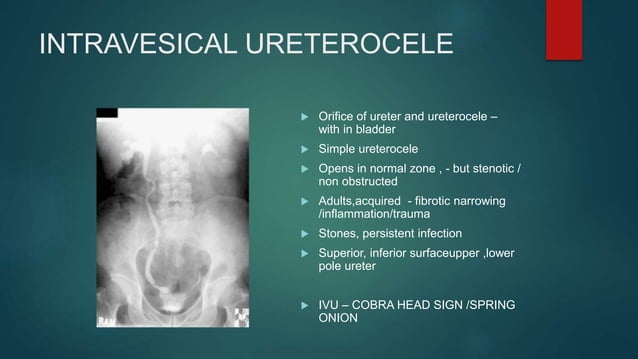 INTRAVENOUS UROGRAM ( IVU ) | PPT
