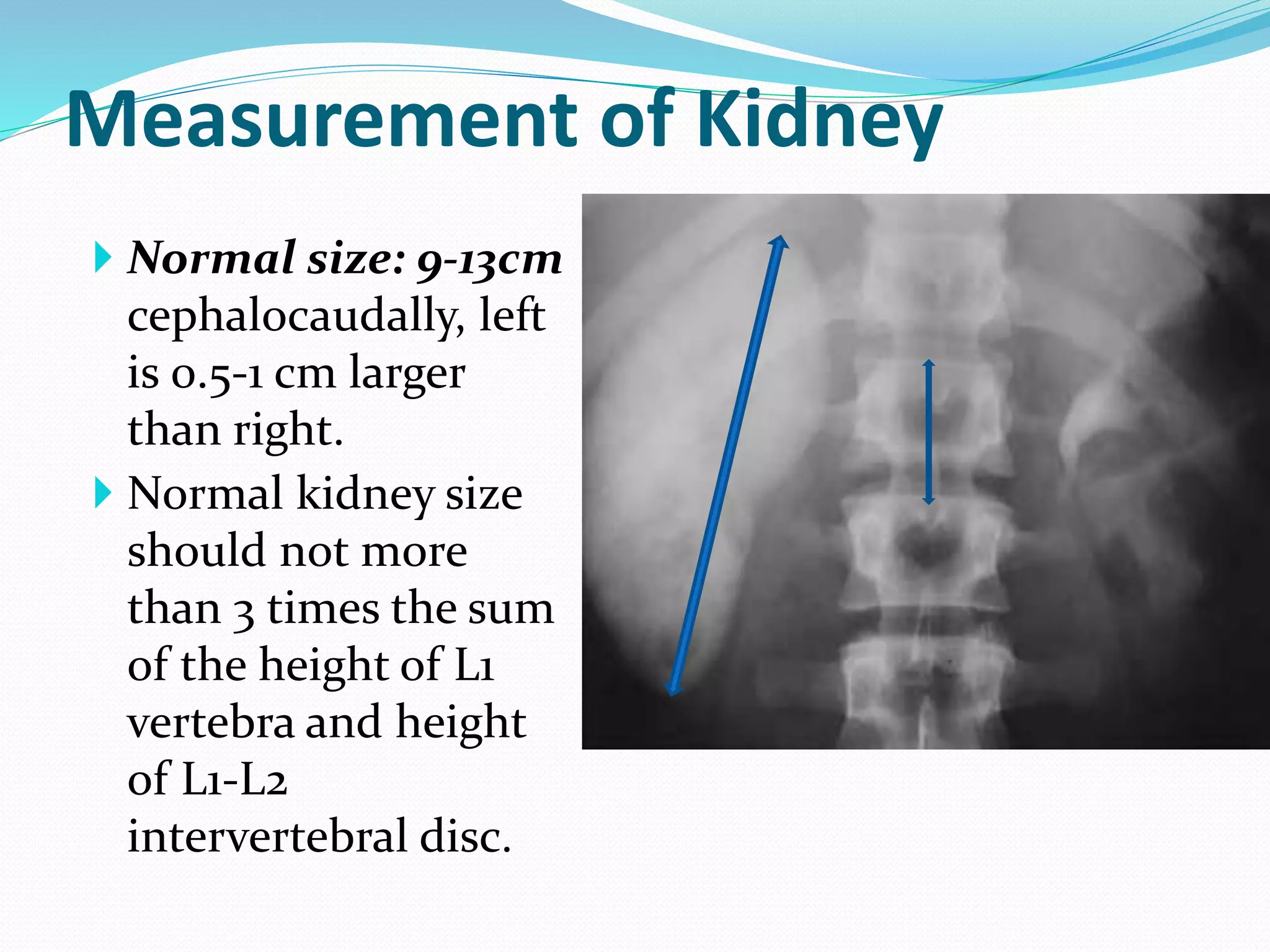  Normal size: 9-13cm
cephalocaudally, left
is 0.5-1 cm larger
than right.
 Normal kidney size
should not more
than 3 times the sum
of the height of L1
vertebra and height
of L1-L2
intervertebral disc.
Measurement of Kidney
 