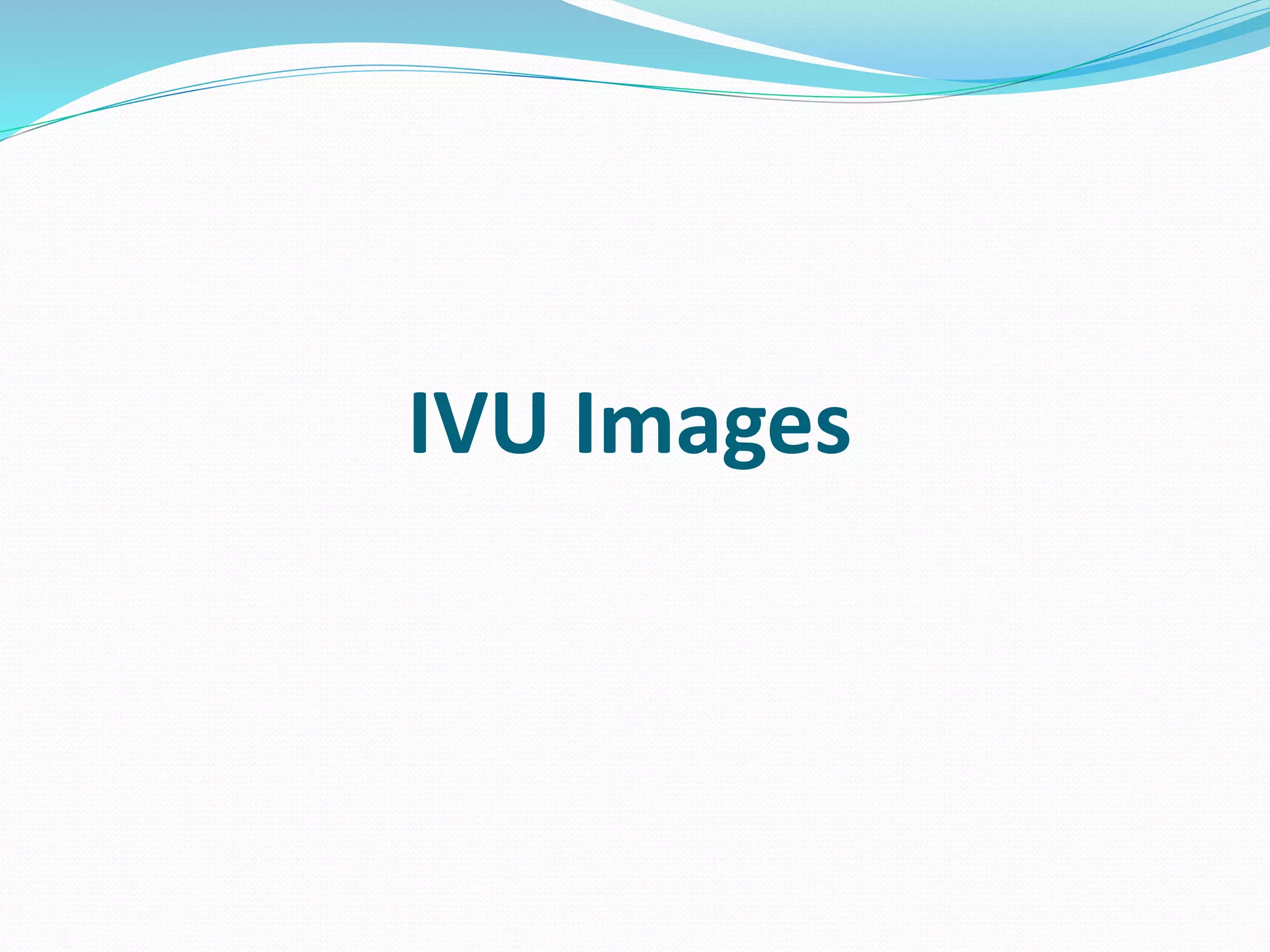 IVU Images
 