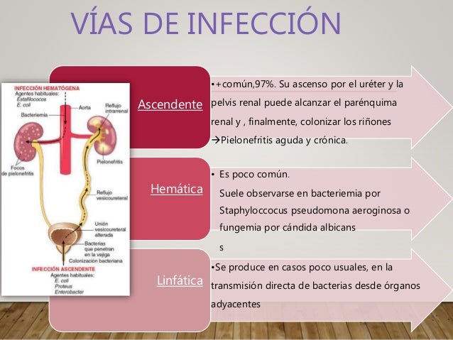 Infeccion De Vias Urinarias No Complicada Gpc www.slideshare.net