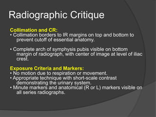 IVU contrasted studies - lecture....pptx