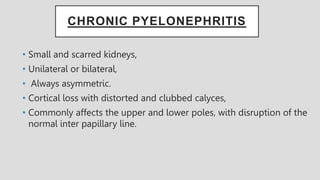CHRONIC PYELONEPHRITIS
• Small and scarred kidneys,
• Unilateral or bilateral,
• Always asymmetric.
• Cortical loss with distorted and clubbed calyces,
• Commonly affects the upper and lower poles, with disruption of the
normal inter papillary line.
 