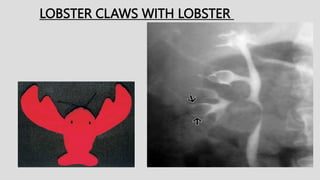 LOBSTER CLAWS WITH LOBSTER
 