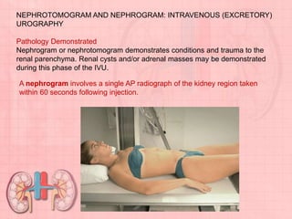 NEPHROTOMOGRAM AND NEPHROGRAM: INTRAVENOUS (EXCRETORY)
UROGRAPHY
Pathology Demonstrated
Nephrogram or nephrotomogram demonstrates conditions and trauma to the
renal parenchyma. Renal cysts and/or adrenal masses may be demonstrated
during this phase of the IVU.
A nephrogram involves a single AP radiograph of the kidney region taken
within 60 seconds following injection.
 