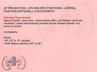 AP PROJECTION • LPO AND RPO POSITIONS • LATERAL
POSITION (OPTIONAL): CYSTOGRAPHY
Pathology Demonstrated
Signs of cystitis, obstruction, vesicoureteral reflux, and bladder calculi are
visualized. Lateral demonstrates possible fistulas between bladder and
uterus or rectum.
Cystography
BASIC
• AP (10° to 15° caudad)
• Both oblique positions (45° to 60°)
 