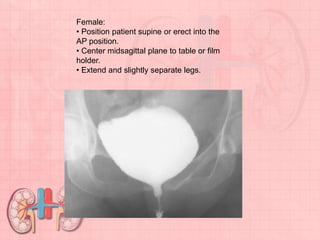 Female:
• Position patient supine or erect into the
AP position.
• Center midsagittal plane to table or film
holder.
• Extend and slightly separate legs.
 