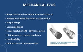 Intravenous Ultrasound | PPTX
