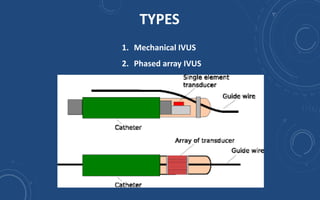 Intravenous Ultrasound | PPTX
