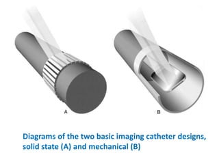 Intravascular Ultrasound (IVUS) | PPTX