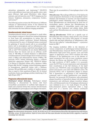 Ivus oct | PDF