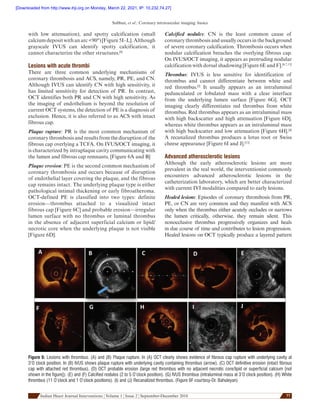 Ivus oct | PDF | Heart and Cardiovascular Diseases | Diseases and ...
