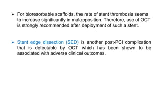  For bioresorbable scaffolds, the rate of stent thrombosis seems
to increase significantly in malapposition. Therefore, use of OCT
is strongly recommended after deployment of such a stent.
 Stent edge dissection (SED) is another post-PCI complication
that is detectable by OCT which has been shown to be
associated with adverse clinical outcomes.
 