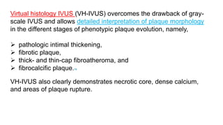 Virtual histology IVUS (VH-IVUS) overcomes the drawback of gray-
scale IVUS and allows detailed interpretation of plaque morphology
in the different stages of phenotypic plaque evolution, namely,
 pathologic intimal thickening,
 fibrotic plaque,
 thick- and thin-cap fibroatheroma, and
 fibrocalcific plaque.78
VH-IVUS also clearly demonstrates necrotic core, dense calcium,
and areas of plaque rupture.
 