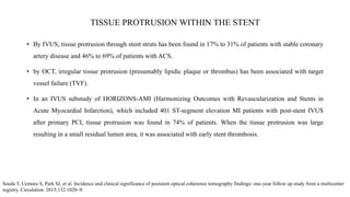 TISSUE PROTRUSION WITHIN THE STENT
• By IVUS, tissue protrusion through stent struts has been found in 17% to 31% of patients with stable coronary
artery disease and 46% to 69% of patients with ACS.
• by OCT, irregular tissue protrusion (presumably lipidic plaque or thrombus) has been associated with target
vessel failure (TVF).
• In an IVUS substudy of HORIZONS-AMI (Harmonizing Outcomes with Revascularization and Stents in
Acute Myocardial Infarction), which included 401 ST-segment elevation MI patients with post-stent IVUS
after primary PCI, tissue protrusion was found in 74% of patients. When the tissue protrusion was large
resulting in a small residual lumen area, it was associated with early stent thrombosis.
Soeda T, Uemura S, Park SJ, et al. Incidence and clinical significance of poststent optical coherence tomography findings: one-year follow up study from a multicenter
registry. Circulation 2015;132:1020–9.
 