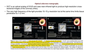 Optical coherence tomography
• OCT is an optical analog of IVUS and uses near-infrared light to produce high-resolution cross-
sectional images of the coronary artery.
• The very high frequency of the light provides 10–15 μ resolution but at the same time limits tissue
penetration to 1–2 mm.
 