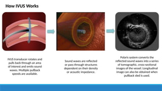 IVUS vs OCT Slide.pptx Imaging guided PCI | PPTX