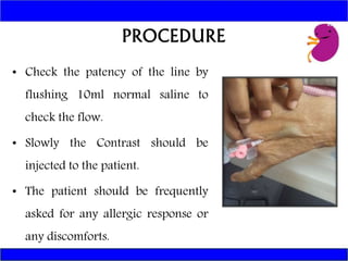INTRAVENOUS UROGRAM | PPTX