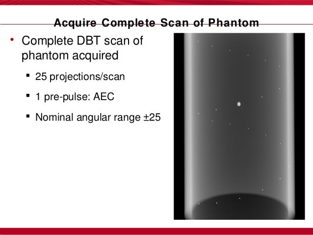 contrast enhanced tomosynthesis contrast enhanced tomosynthesis