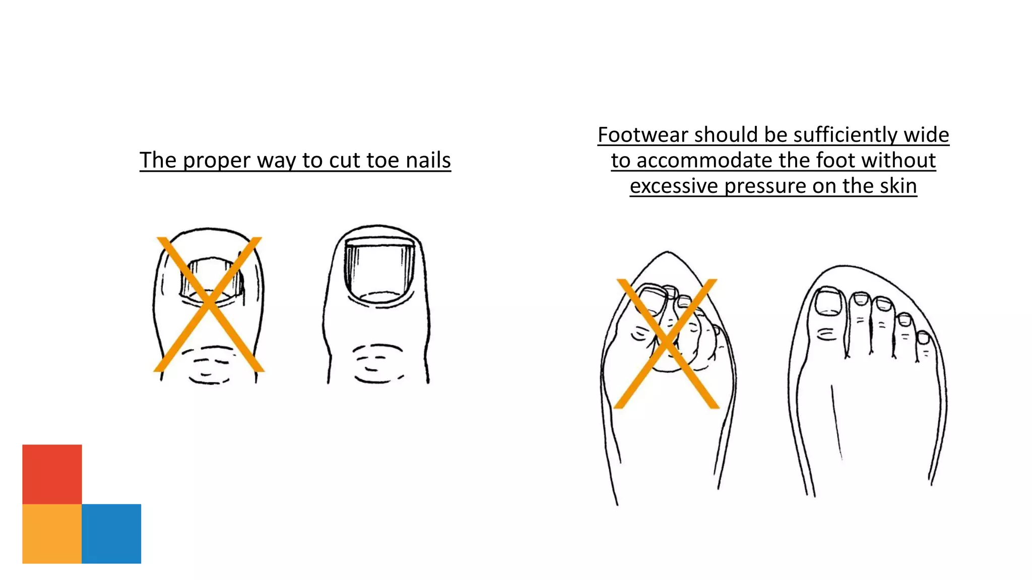 Footwear should be sufficiently wide
to accommodate the foot without
excessive pressure on the skin
The proper way to cut toe nails
 