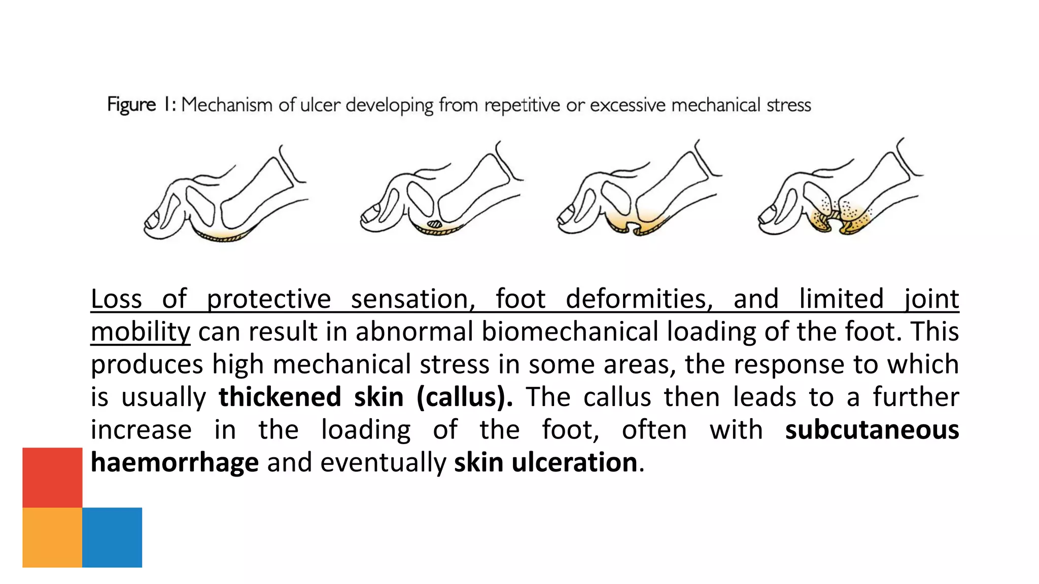 Loss of protective sensation, foot deformities, and limited joint
mobility can result in abnormal biomechanical loading of the foot. This
produces high mechanical stress in some areas, the response to which
is usually thickened skin (callus). The callus then leads to a further
increase in the loading of the foot, often with subcutaneous
haemorrhage and eventually skin ulceration.
 