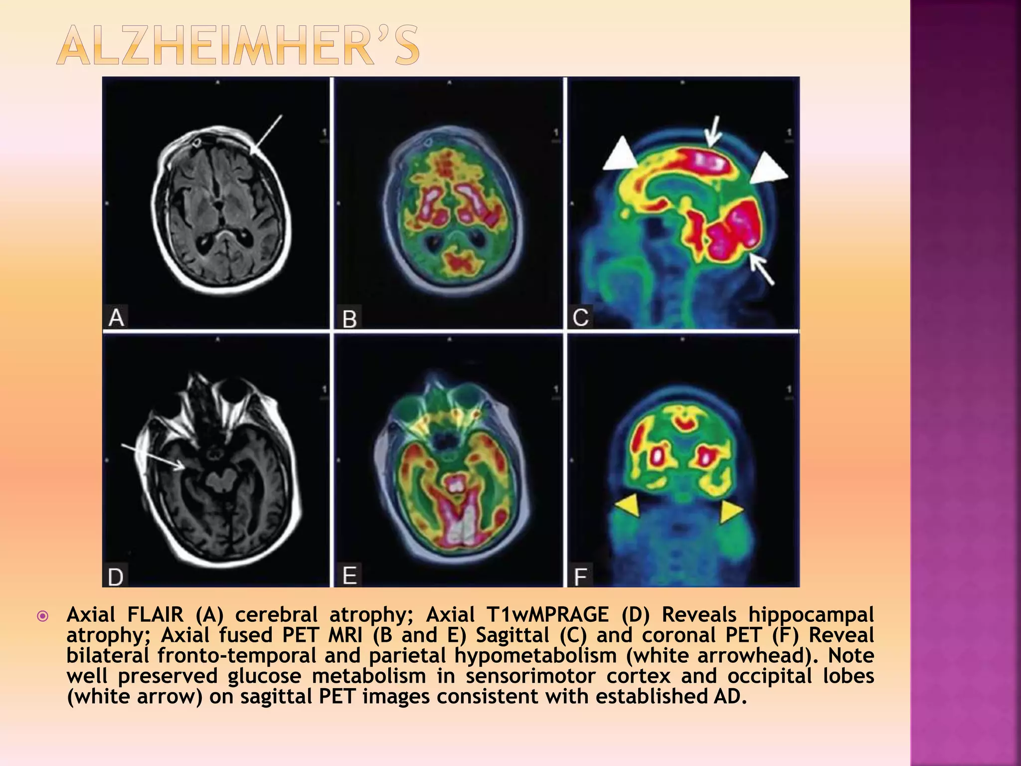 Clinacal applications of PET/CT vs PET/MRI | PPTX