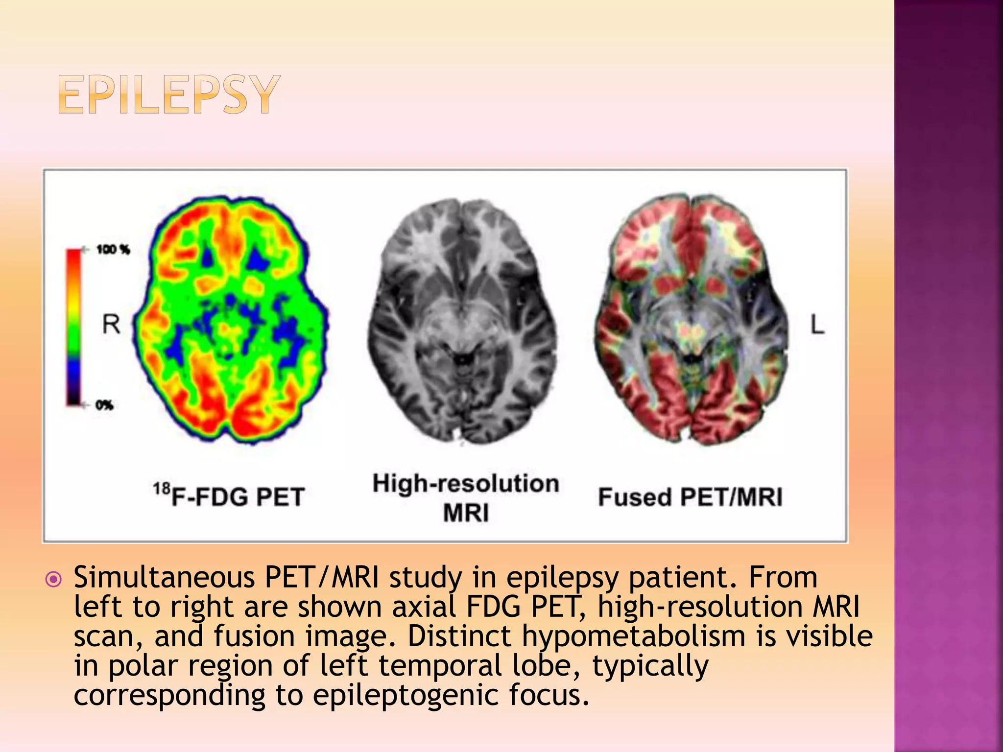 Clinacal applications of PET/CT vs PET/MRI | PPTX