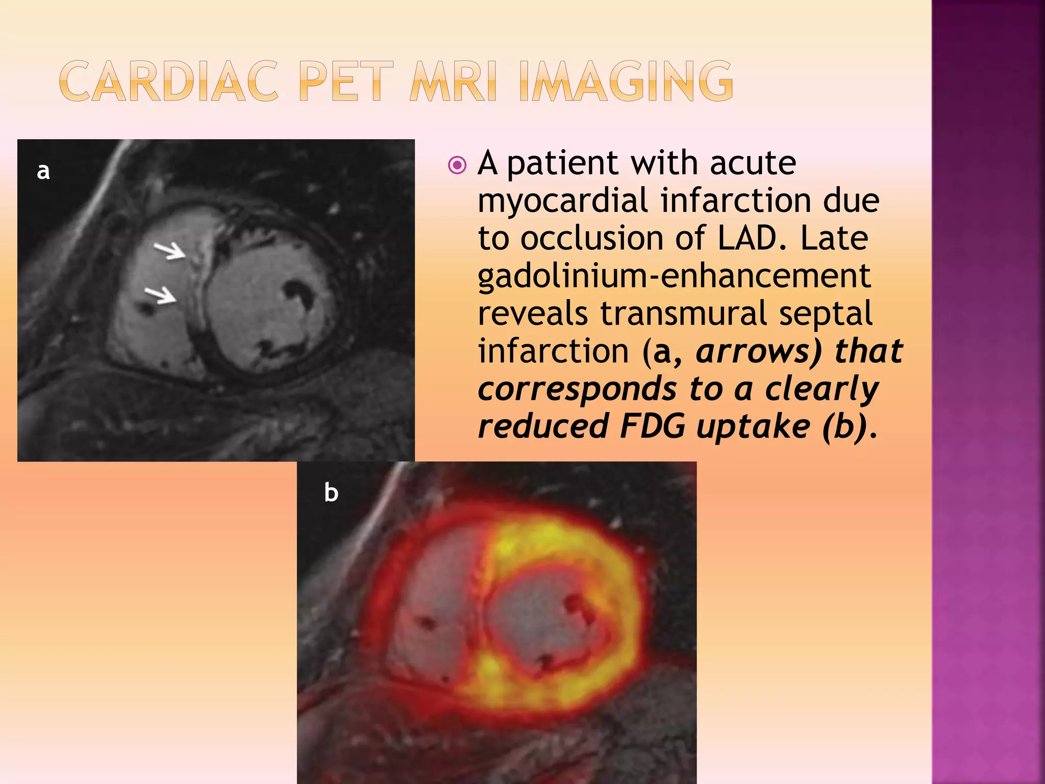 Clinacal applications of PET/CT vs PET/MRI | PPTX