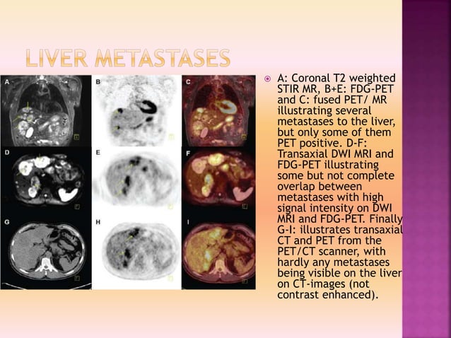 Clinacal applications of PET/CT vs PET/MRI | PPTX