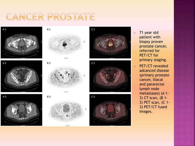 Clinacal applications of PET/CT vs PET/MRI | PPTX
