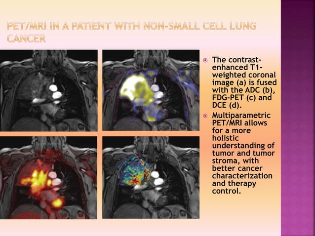 Clinacal applications of PET/CT vs PET/MRI | PPTX