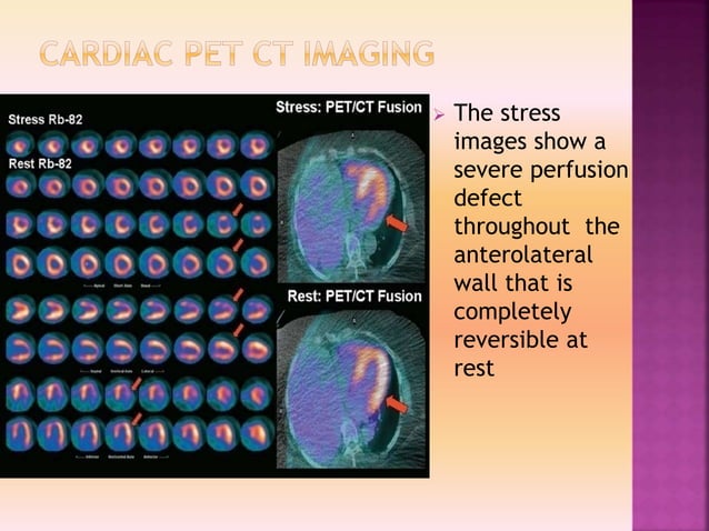 Clinacal applications of PET/CT vs PET/MRI | PPTX