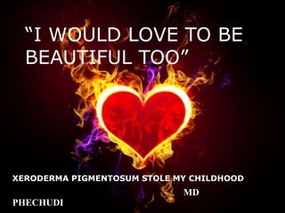 “I WOULD LOVE TO BE
BEAUTIFUL TOO”
XERODERMA PIGMENTOSUM STOLE MY CHILDHOOD
MD
PHECHUDI
 