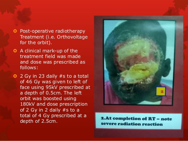 I Would Love To Be Beautiful Too