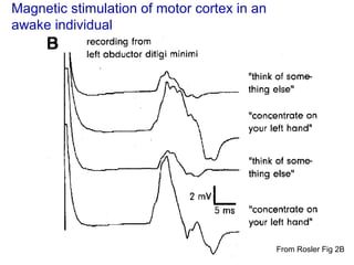 Anatomy and Physiology of Motor disorder | PPT